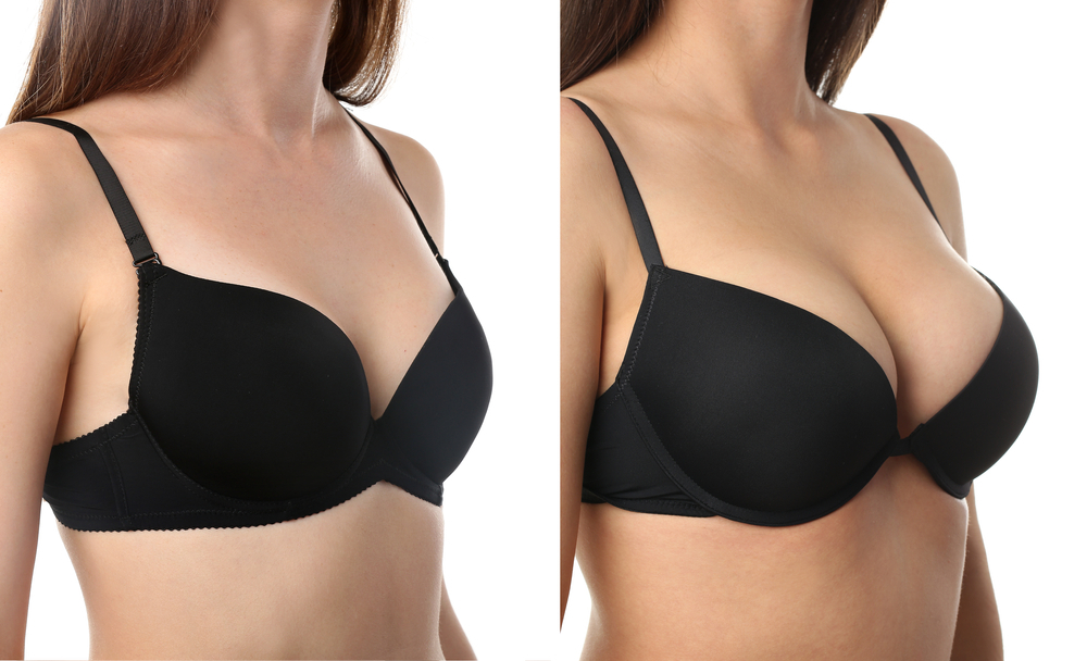 Subtle Lifts, Stunning Results: Breast Enhancement
